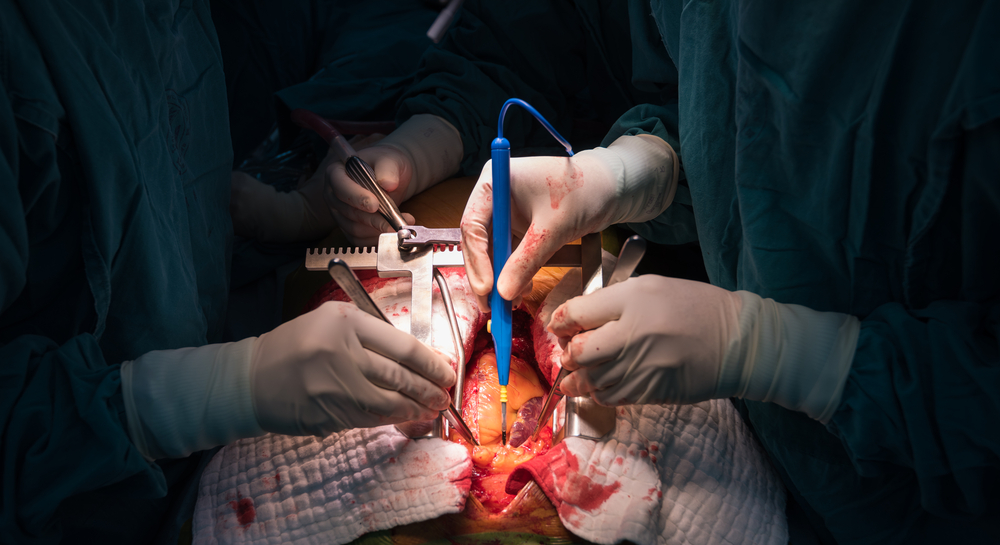 Heart Surgery